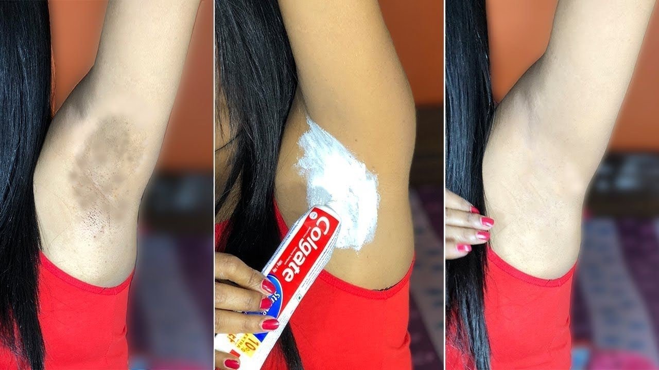Blanquea tus axilas de forma natural con pasta de dientes
