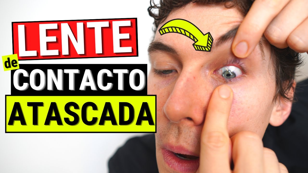 Solución rápida: lente de contacto roto