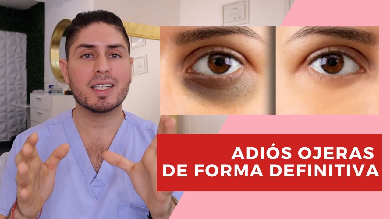 ¡Di adiós a las ojeras de forma definitiva!