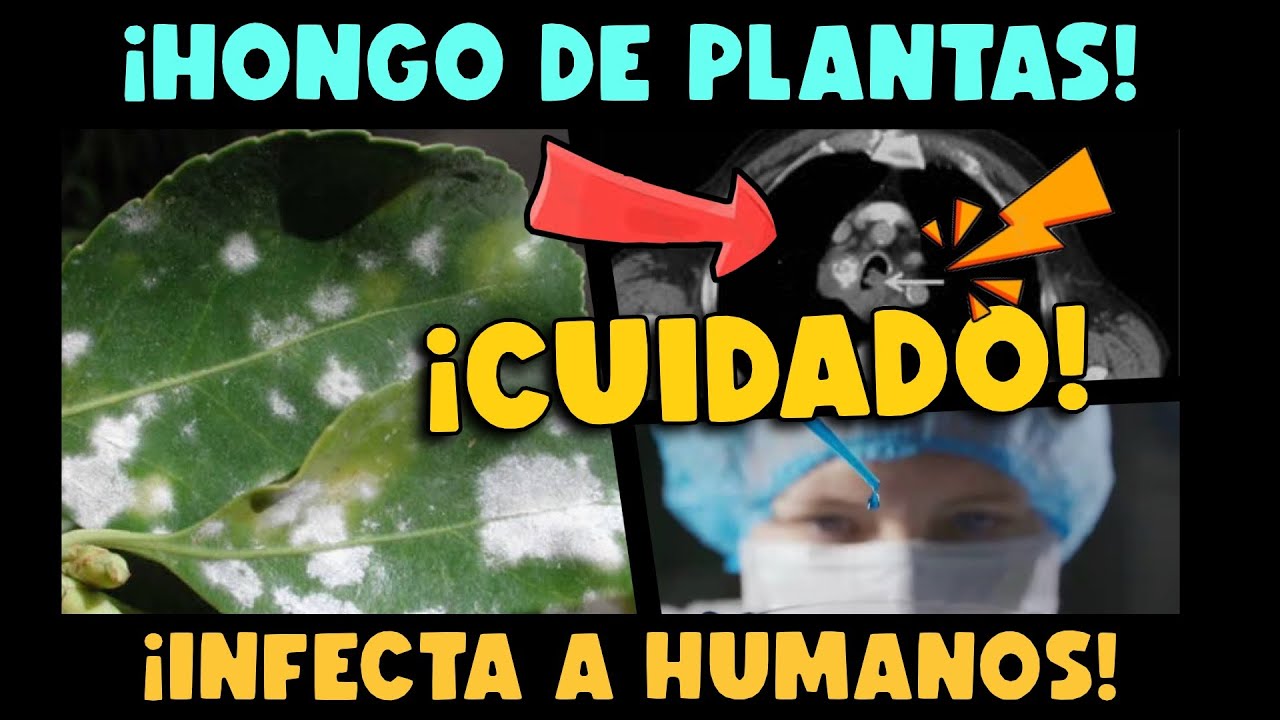 Enfermedades causadas por plantas a humanos