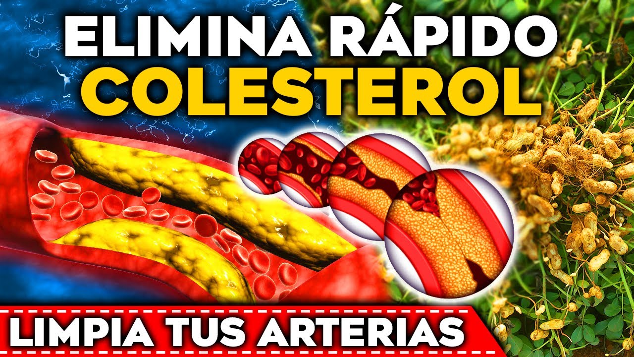 Pastillas naturales para disminuir el colesterol