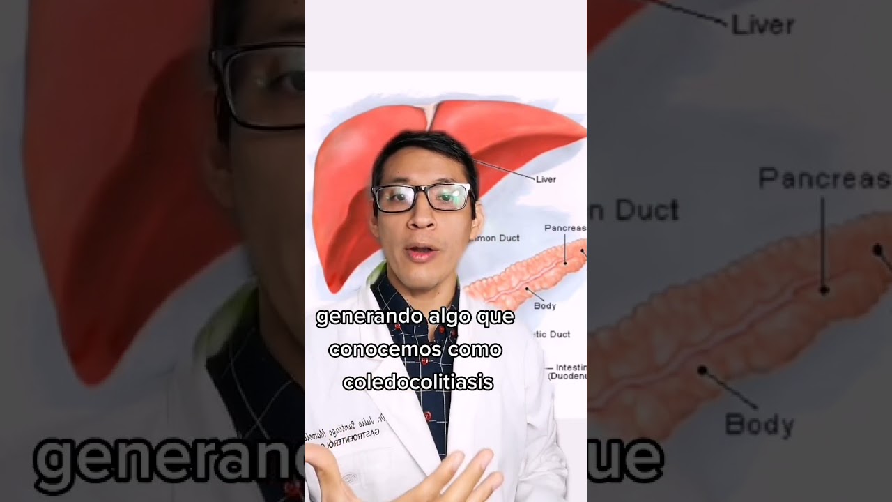 Peligros de tener cálculos en la vesícula