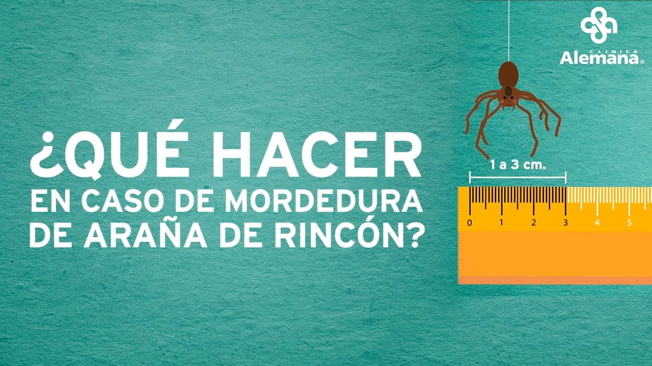 Qué causa la picadura de tarántula: Los efectos de la picadura de tarántula
