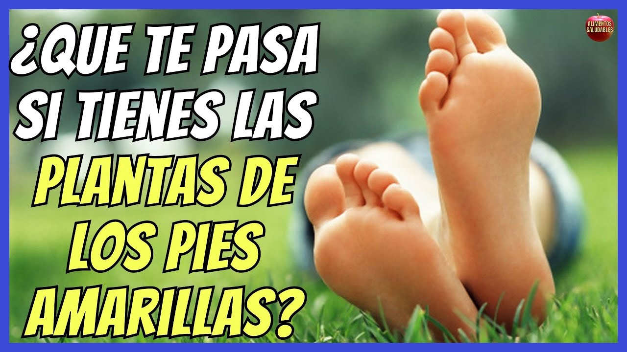 ¿Por qué mis plantas de los pies están amarillas?